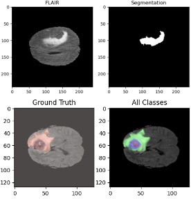 Brain Tumor Segmentation